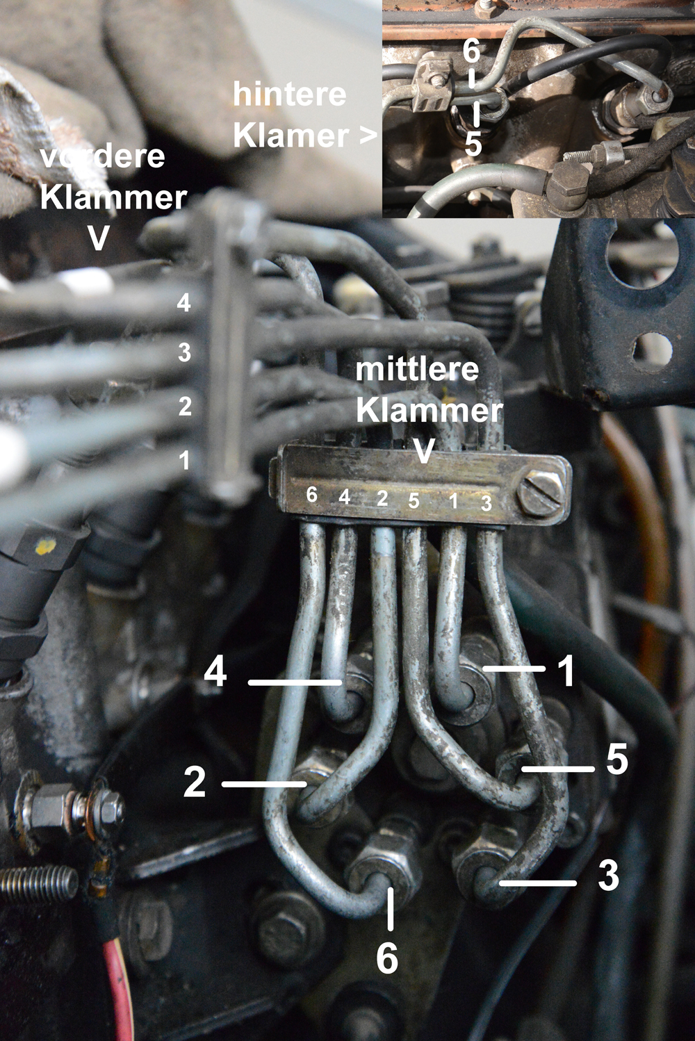 Einspritzleitungen, Lage der Klammern